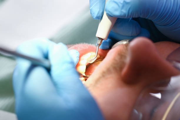 Best Walk-In Emergency Dentist in Dover, AR