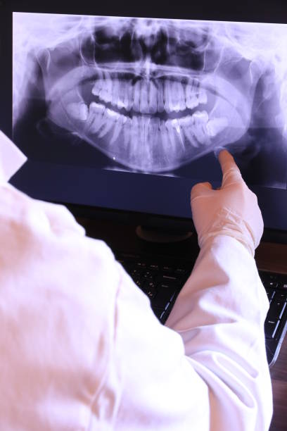 Best Emergency Tooth Extraction in Dover, AR